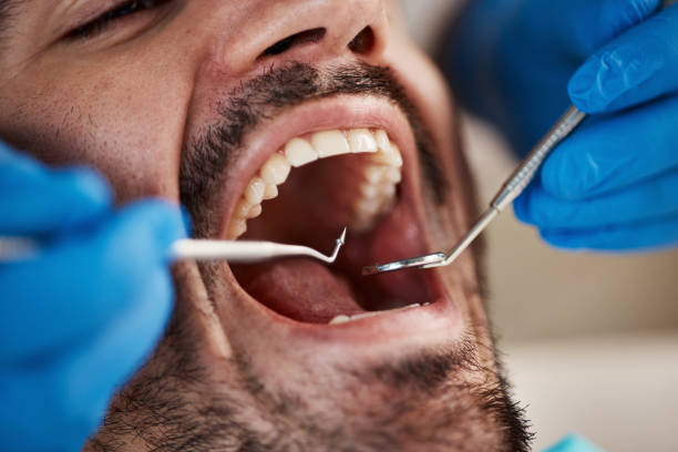 Best Same-Day Emergency Dental Services in Conehatta, MS